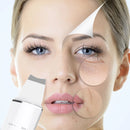 Ultrasonic Face Scrubber & Exfoliator Machine-4